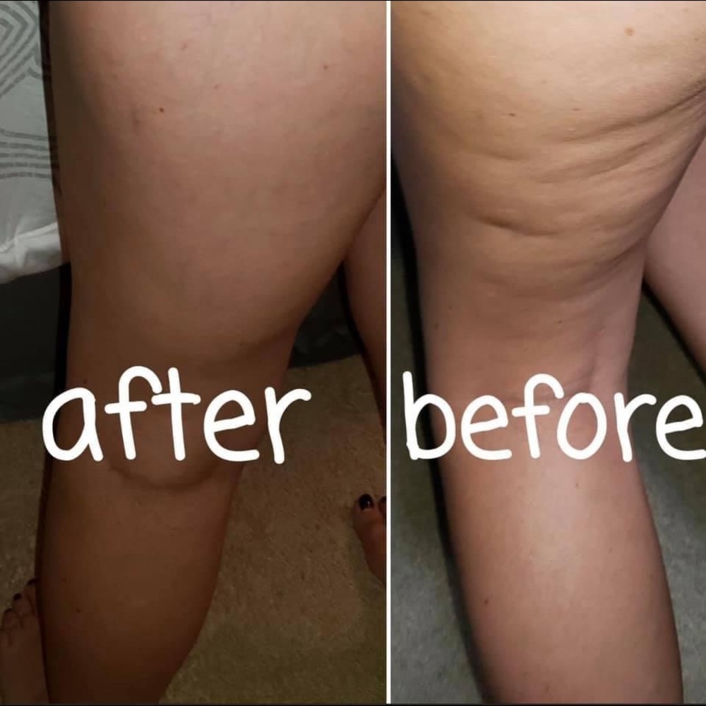 Neora Firm Body Contouring Cream